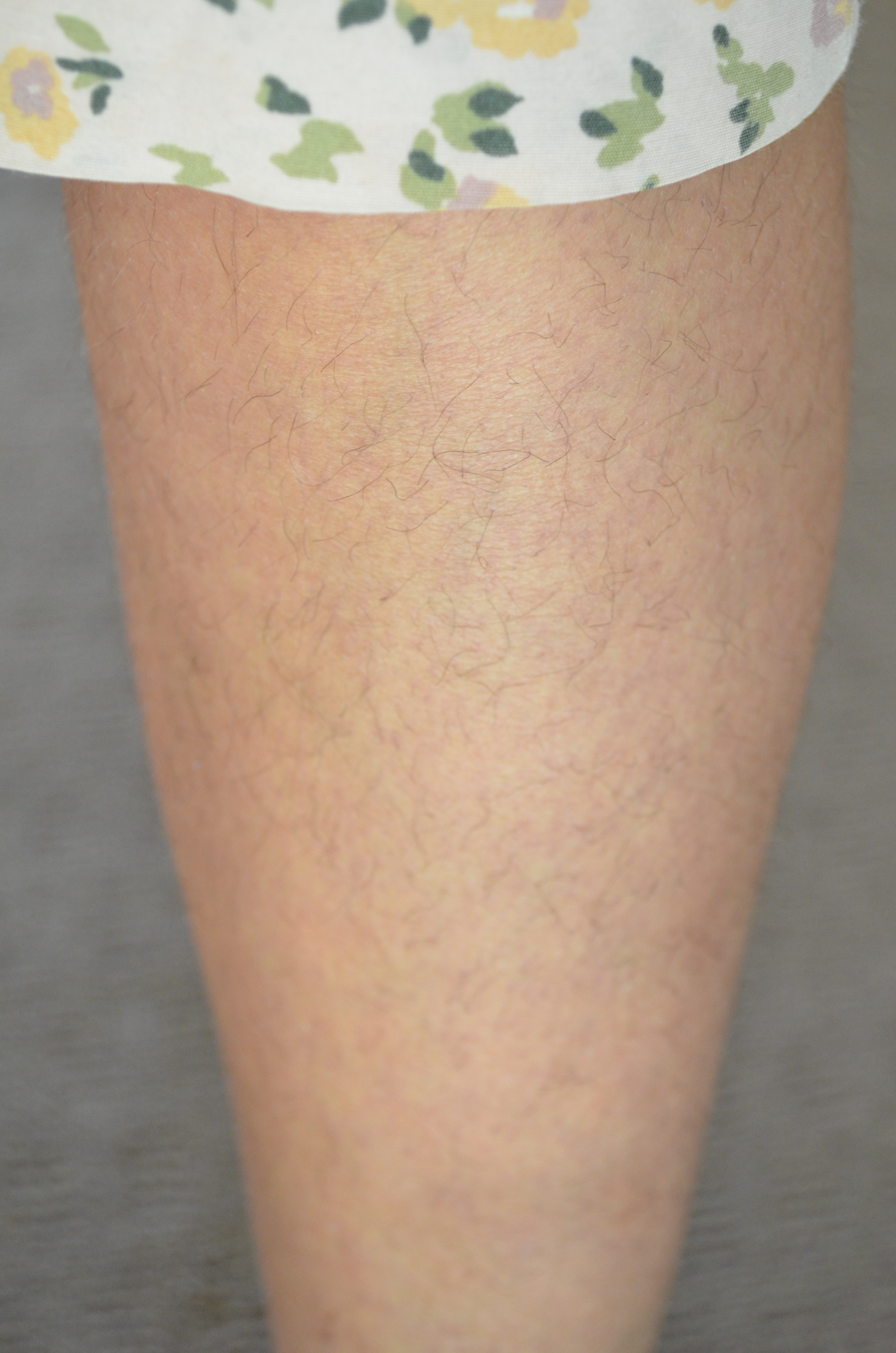 Body hair experiment – results